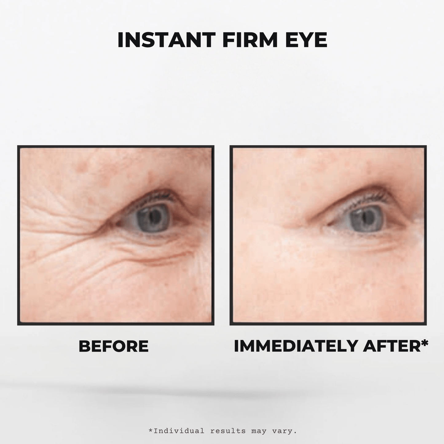 INSTANT FIRM EYE™ - TheFreshFaceShop