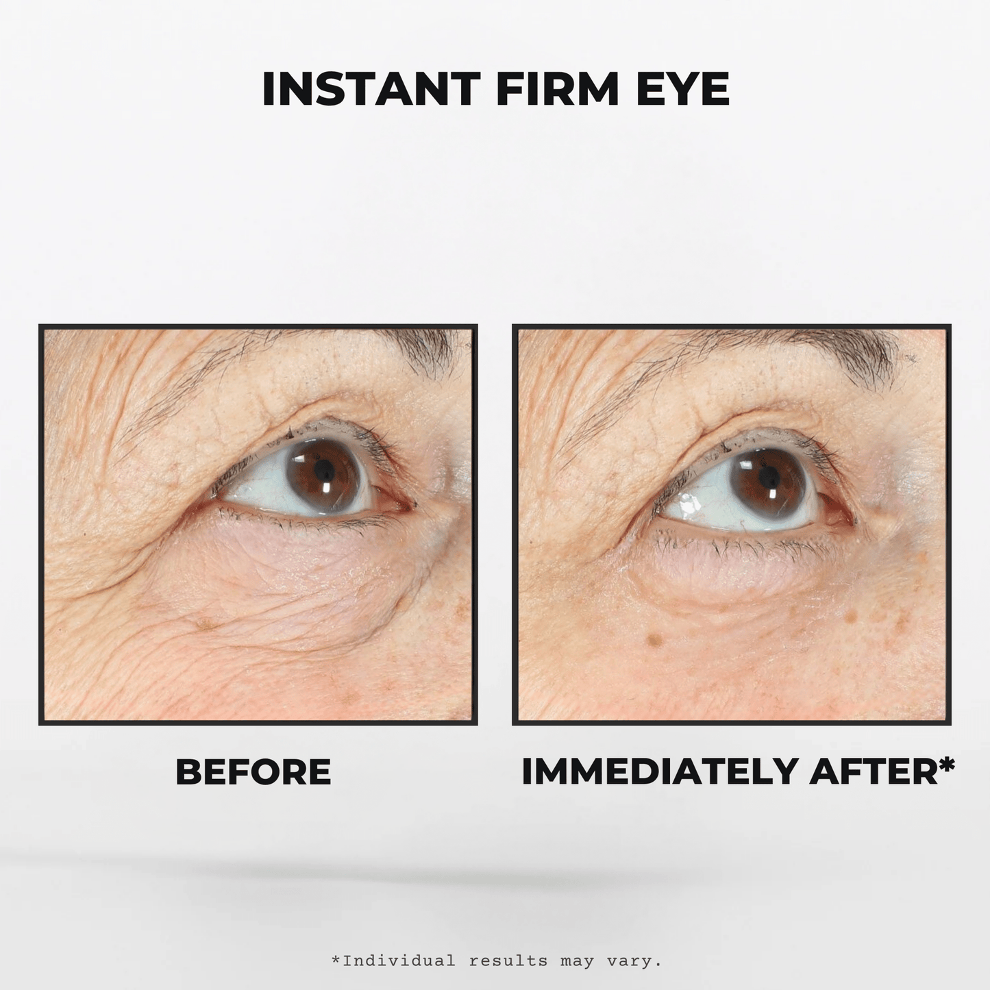 INSTANT FIRM EYE™ - TheFreshFaceShop