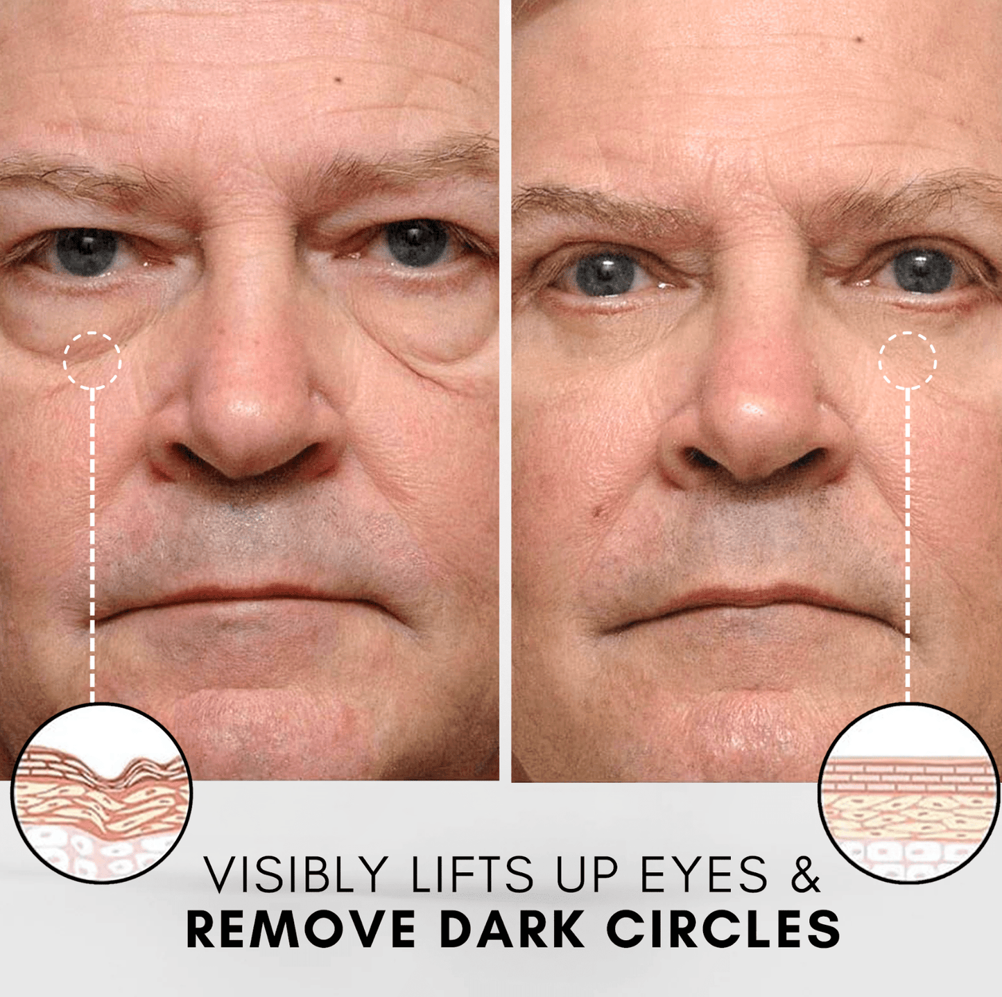 INSTANT FIRM EYE 2 - TheFreshFaceShop